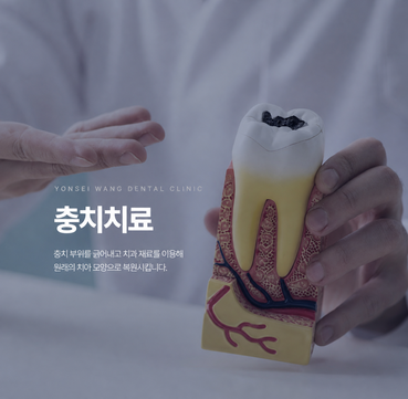연세왕치과의원 충치치료